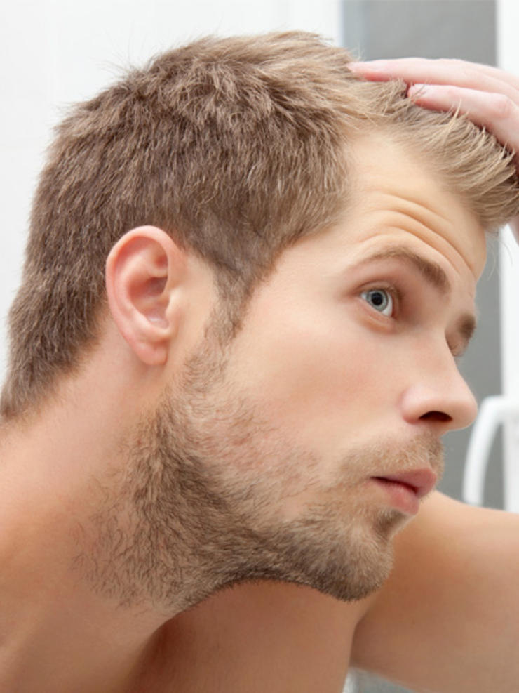 how to regrow receding hairline